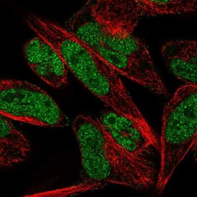 Immunocytochemistry/ Immunofluorescence: THAP1 Antibody [NBP2-56308]