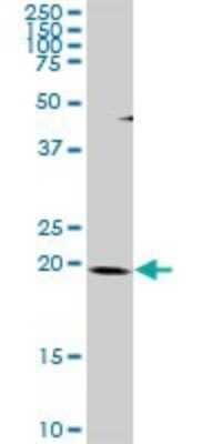 Western Blot: THAP1 Antibody [H00055145-D01P]