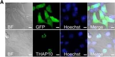 Immunocytochemistry/ Immunofluorescence: THAP10 Antibody [NBP1-86226]