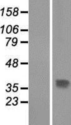 Western Blot: THAP10 Overexpression Lysate [NBP2-06665]