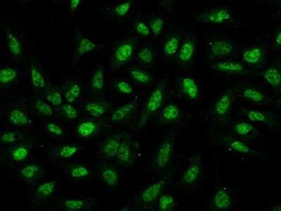 Immunocytochemistry/ Immunofluorescence: THAP11 Antibody [NBP2-97155]