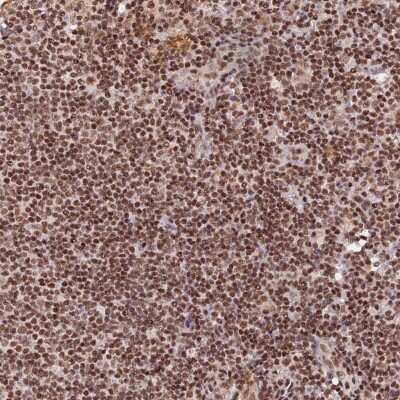 Immunohistochemistry-Paraffin: THAP11 Antibody [NBP1-92494]