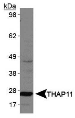 Western Blot: THAP11 Antibody [NBP1-49463]