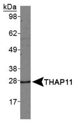 Western Blot: THAP11 Antibody [NBP1-49463]