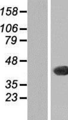 Western Blot: THAP11 Overexpression Lysate [NBP2-06641]