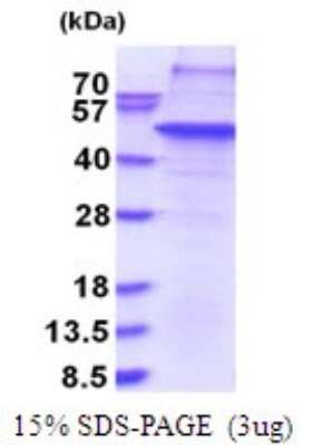 SDS-PAGE: Recombinant Human THAP11 His Protein [NBP2-51754]