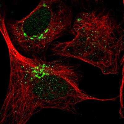 Immunocytochemistry/ Immunofluorescence: THAP2 Antibody [NBP1-84157]