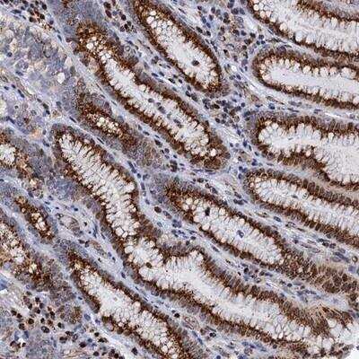 Immunohistochemistry-Paraffin: THAP2 Antibody [NBP1-84157]