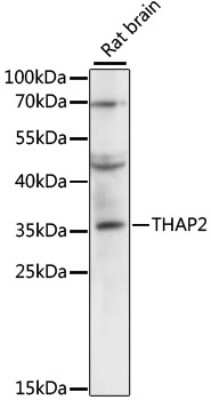 Western Blot: THAP2 AntibodyAzide and BSA Free [NBP2-94861]