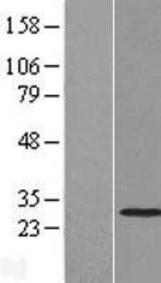 Western Blot: THAP2 Overexpression Lysate [NBL1-16873]