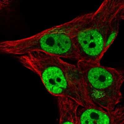 Immunocytochemistry/ Immunofluorescence: THAP3 Antibody [NBP2-57825]