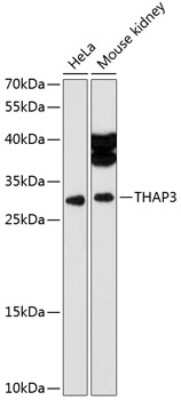 Western Blot: THAP3 AntibodyAzide and BSA Free [NBP2-93451]