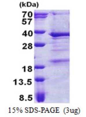 SDS-PAGE: Recombinant Human THAP3 His Protein [NBP2-22860]