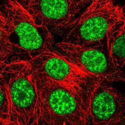 Immunocytochemistry/ Immunofluorescence: THAP4 Antibody [NBP2-55100]