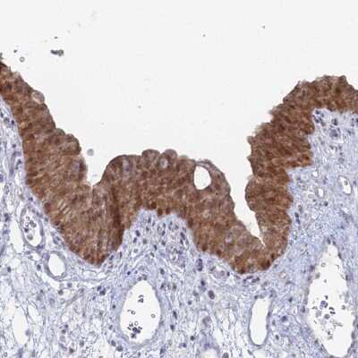 Immunohistochemistry-Paraffin: THAP4 Antibody [NBP1-92496]