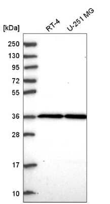 Western Blot: THAP5 Antibody [NBP2-55522]