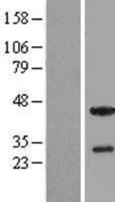 Western Blot: THAP5 Overexpression Lysate [NBL1-16874]