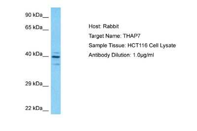 Western Blot: THAP7 Antibody [NBP2-83649]