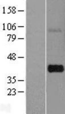 Western Blot: THAP7 Overexpression Lysate [NBP2-09124]