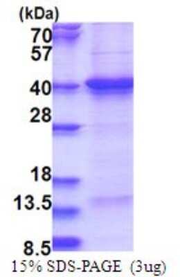 SDS-PAGE: Recombinant Human THAP7 His Protein [NBP2-51729]