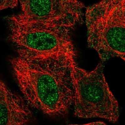 Immunocytochemistry/ Immunofluorescence: THAP8 Antibody [NBP2-55908]