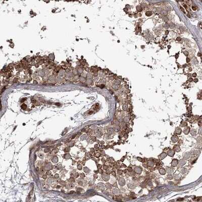 Immunohistochemistry-Paraffin: THAP9 Antibody [NBP1-93848]