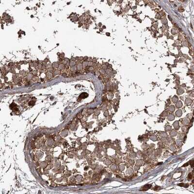 Immunohistochemistry-Paraffin: THAP9 Antibody [NBP2-38344]