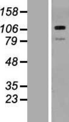 Western Blot: Thrombospondin-3 Overexpression Lysate [NBP2-07529]