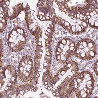 Immunohistochemistry: THEGL Antibody [NBP2-49543]