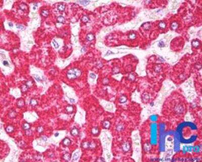 Immunohistochemistry-Paraffin: THEM2 Antibody [NBP2-24655]