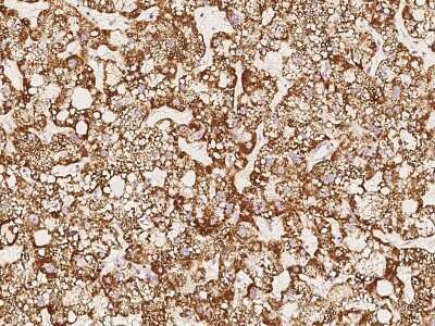 Immunohistochemistry-Paraffin: THEM2 Antibody [NBP2-97056]