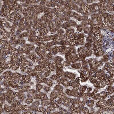 Immunohistochemistry-Paraffin: THEM2 Antibody [NBP3-16979]