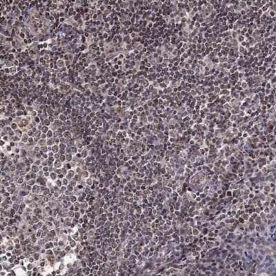 Immunohistochemistry-Paraffin: THEM2 Antibody [NBP3-16979]