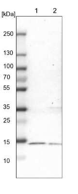 Western Blot: THEM2 Antibody [NBP1-92498]