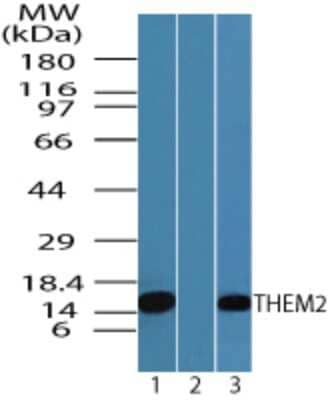 Western Blot: THEM2 Antibody [NBP2-24655]