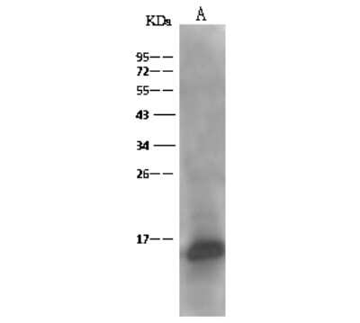 Western Blot: THEM2 Antibody [NBP2-97056]