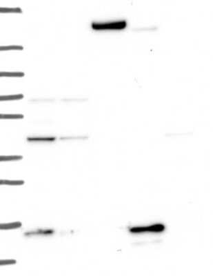 Western Blot: THEM2 Antibody [NBP3-16979]