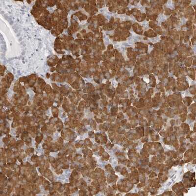 Immunohistochemistry-Paraffin: THEM4 Antibody [NBP1-84336]