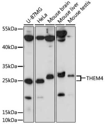 Western Blot: THEM4 AntibodyAzide and BSA Free [NBP2-94437]