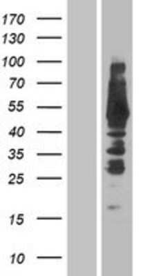 Western Blot: THEM4 Overexpression Lysate [NBP2-04410]