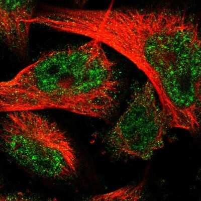 Immunocytochemistry/ Immunofluorescence: THEM6 Antibody [NBP1-84052]