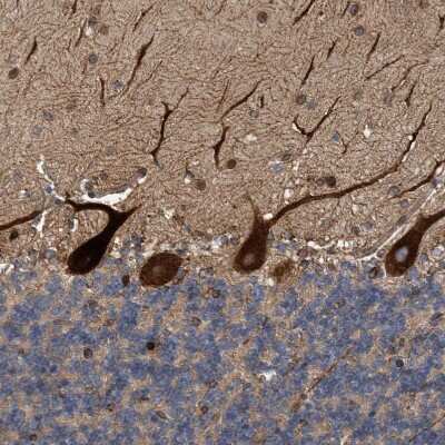 Immunohistochemistry-Paraffin: THEM6 Antibody [NBP1-84052]