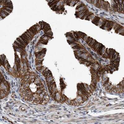 Immunohistochemistry-Paraffin: THEM6 Antibody [NBP1-84052]