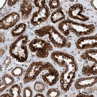 Immunohistochemistry-Paraffin: THEM6 Antibody [NBP1-84052]