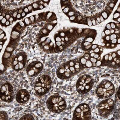 Immunohistochemistry-Paraffin: THEM6 Antibody [NBP1-84052]