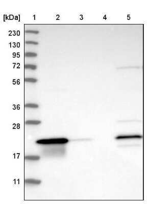 Western Blot: THEM6 Antibody [NBP1-84052]