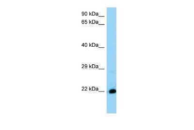 Western Blot: THEM6 Antibody [NBP2-85908]