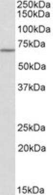 Western Blot: Themis Antibody [NBP2-27492]