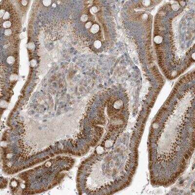 Immunohistochemistry-Paraffin: THG1L Antibody [NBP1-82315]