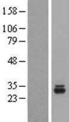 Western Blot: THG1L Overexpression Lysate [NBL1-16885]